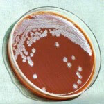 img-bacteria